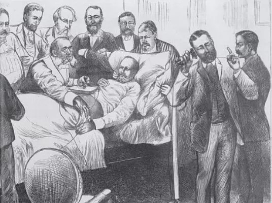 Alexander Graham Bell used metal detector to locate a bullet lodged in the chest of American President James Garfield