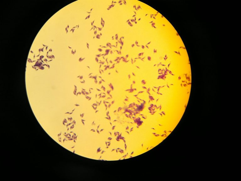 Charles Nicolle and Louis Manceaux at the Pasteur Institute first described Toxoplasma gondii