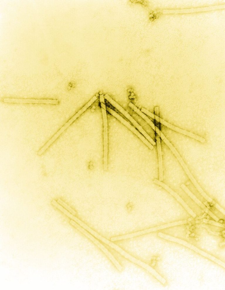 Wyckoff and  Williams introduced the shadowing of electron microscope specimens