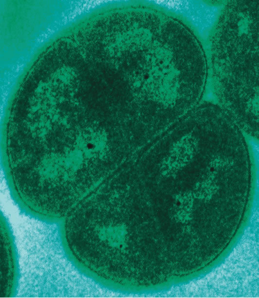 Deinococcus radiodurans was first reported