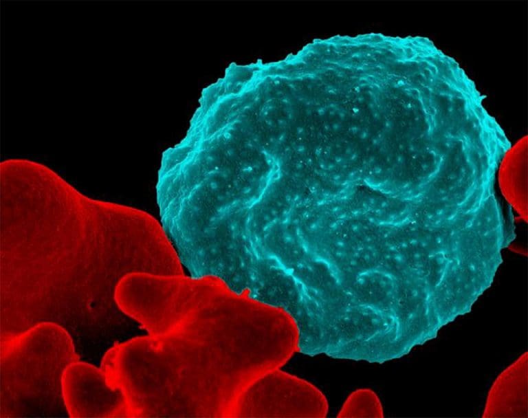 NIH researchers discovered new set of channels connecting malaria parasite and blood cells
