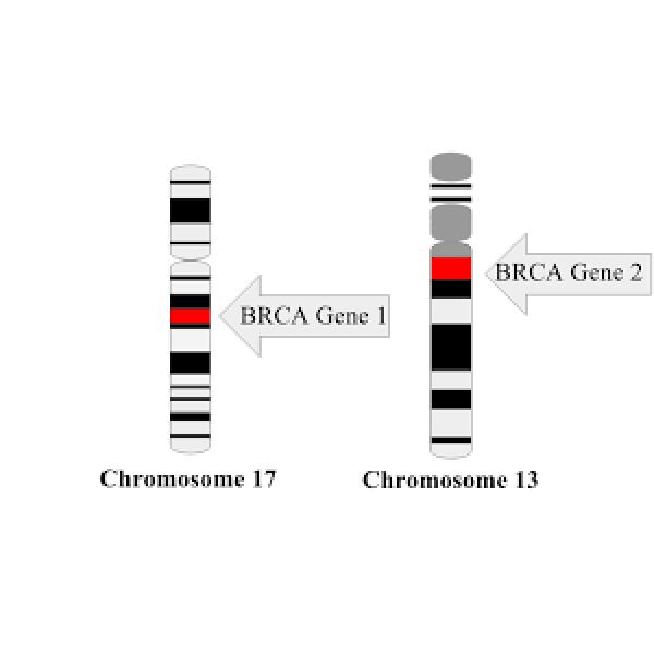 BRCA2 gene mapped to chromosome 13q12-13
