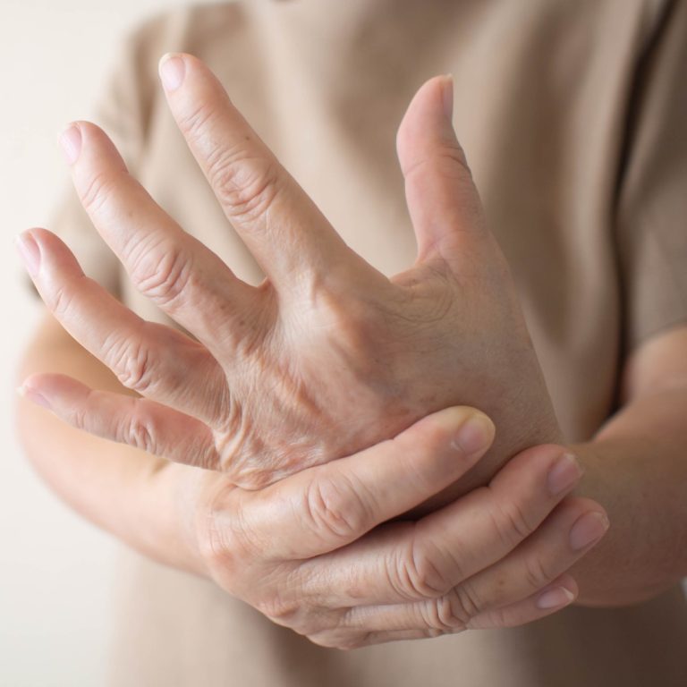 Stanford Medicine scientists tie lupus to a virus nearly all of us carry