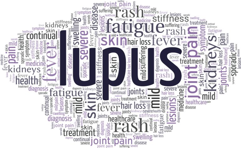 Drs. Judith James and John Harley at the OMRF published an important study that showed certain antibodies for lupus were typically present years before the disease with diagnosed