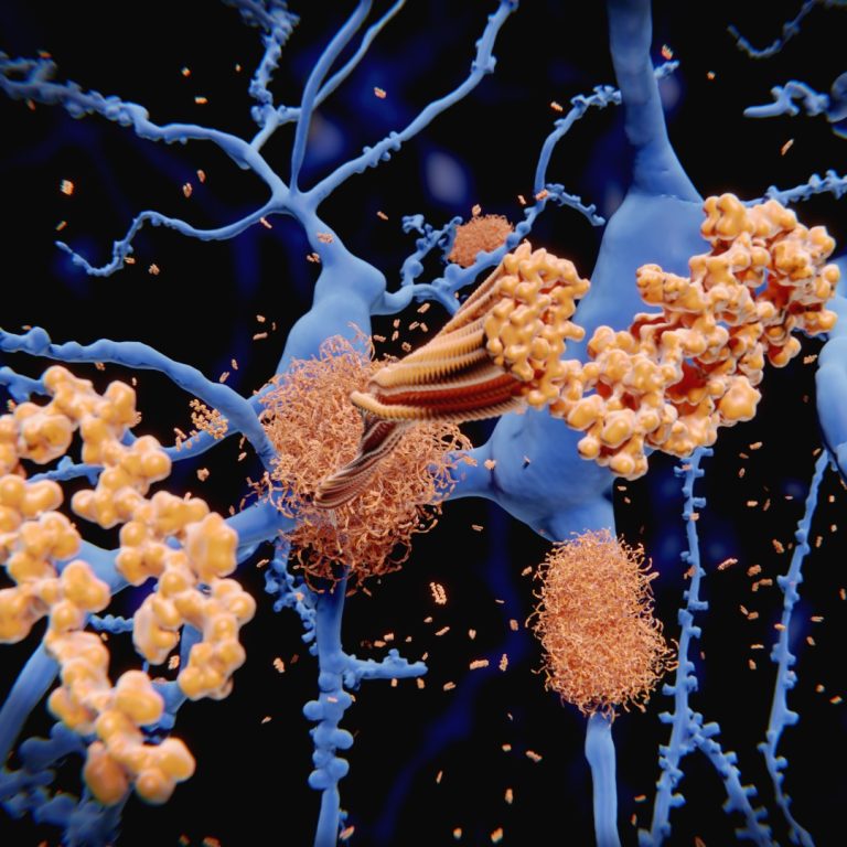 First international collaboration on Alzheimer’s disease genetics was launched