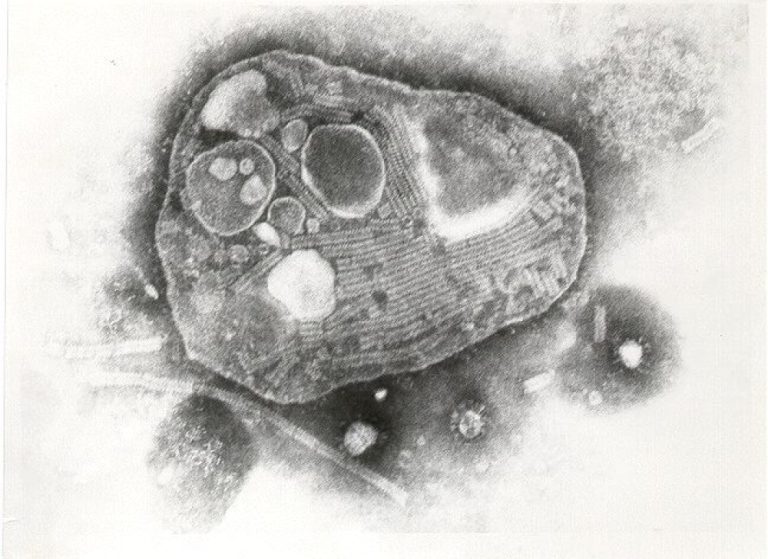 Global eradication of rinderpest (cattle plague) was declared