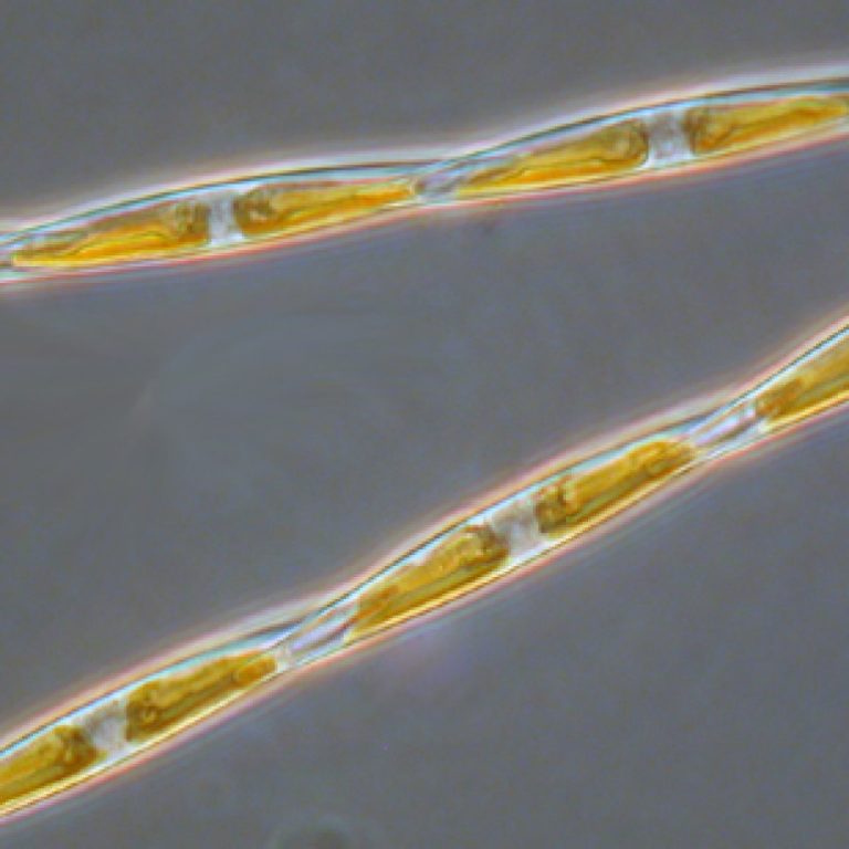 Researchers discovered unique ways diatoms metabolize nitrogen, enabling them to thrive in dynamic environments