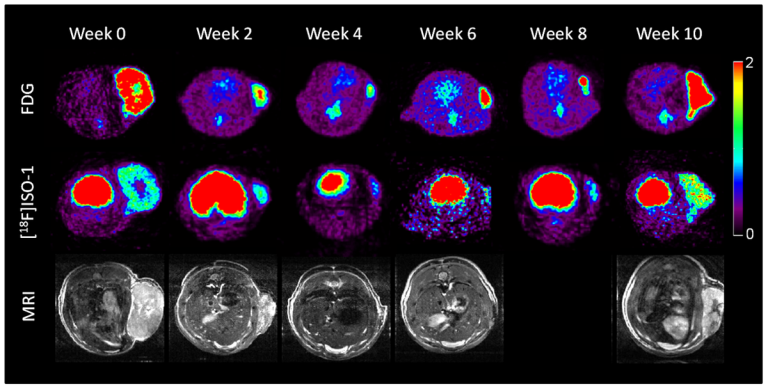 Fluorescent molecular probes developed, revolutionizing tumor cell detection