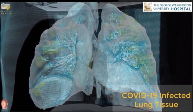 GW Hospital used VR technology to see into COVID-19 patient’s lungs