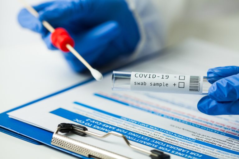 The  FDA issued EUA for first antigen test to help in rapid detection of virus that causes COVID-19 in patients