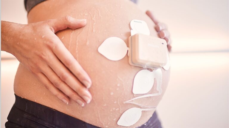 Philips launched obstetrics monitoring solution to support clinicians and expectant mothers during COVID-19 pandemic