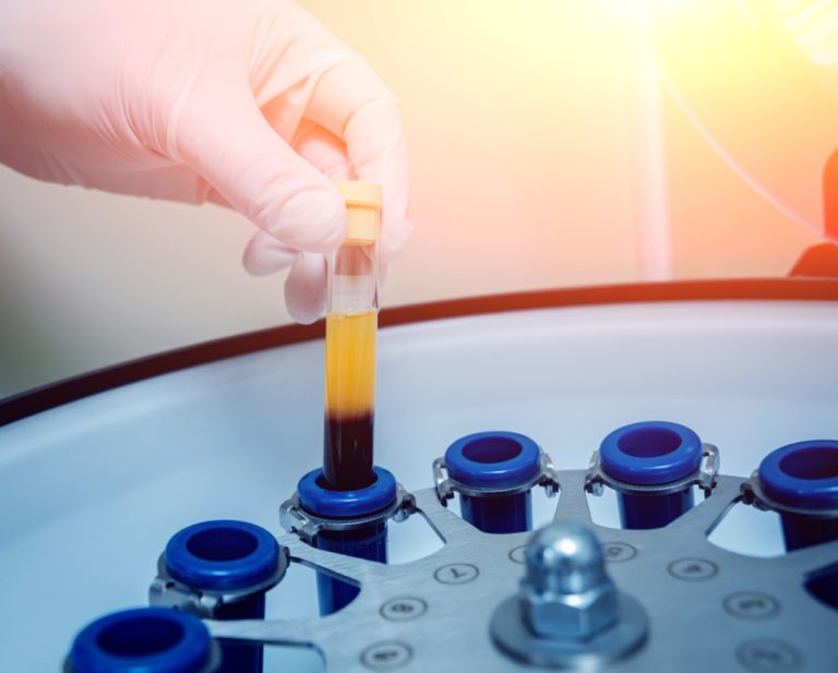 Mayo Clinic Laboratories launched serology testing in support of COVID-19 response