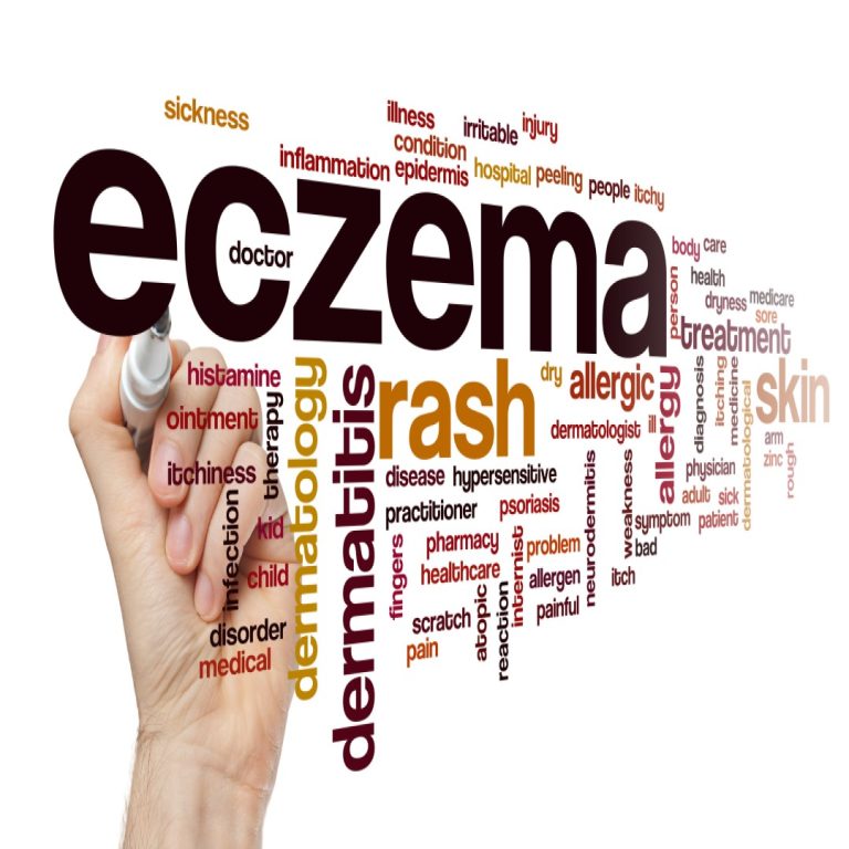 Developmental origins of eczema and psoriasis discovered