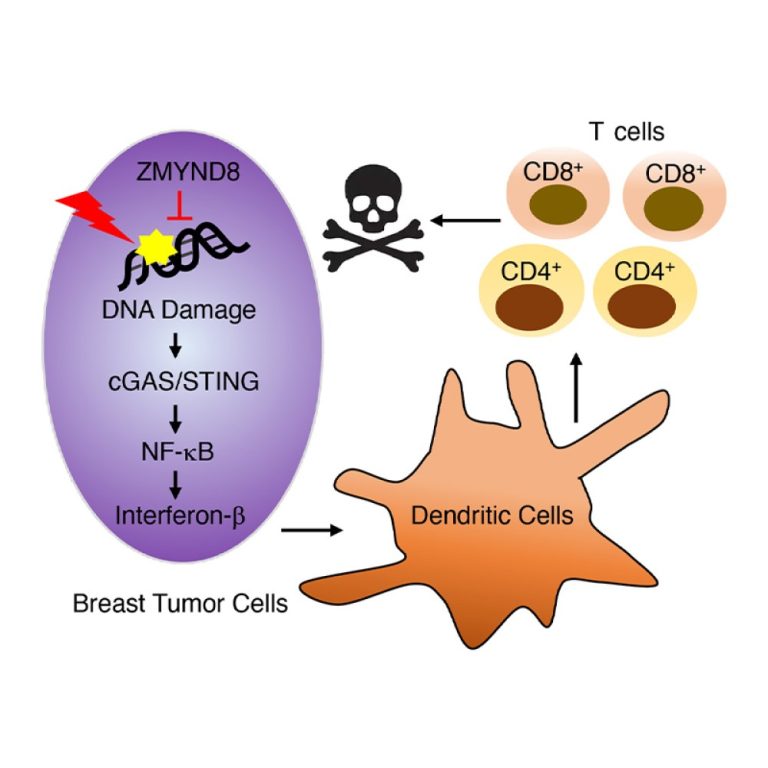 UTSW researchers identified new gene involved in breast cancer growth