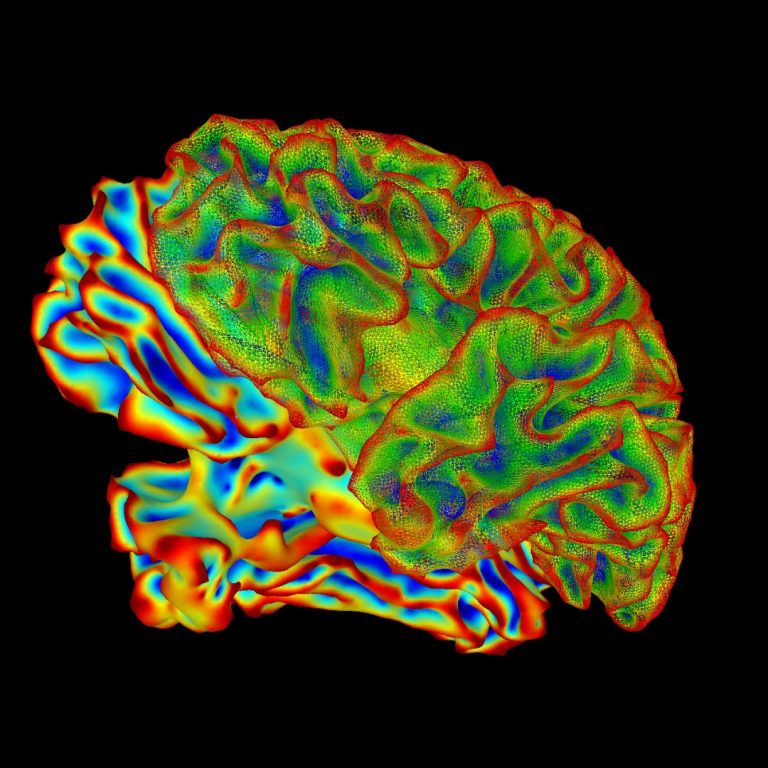 Brain Scans revealed changes from Long COVID Fatigue