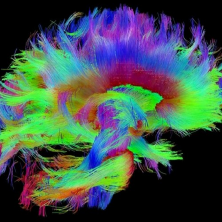 NIH study showed highly reproducible sex differences in aspects of human brain anatomy