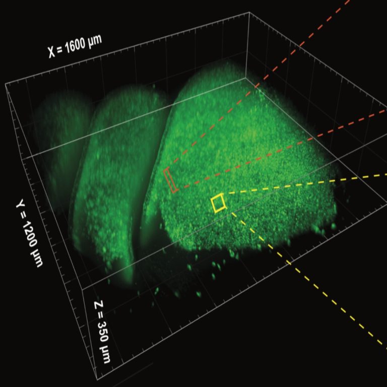 Scientists unveiled complete cell map of a whole mammalian brain