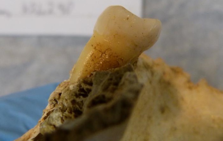 Genetic secrets from 4,000-year-old teeth illuminate the impact of changing human diets over the centuries