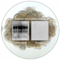 NIH scientists used human cerebral organoid to test drug for deadly brain disease