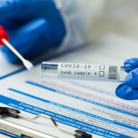 U.S. FDA permitted marketing of first COVID-19 at-home test using traditional premarket review process