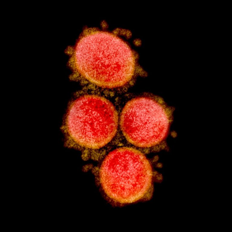 SARS (Severe Acute Respiratory Syndrome) was first discovered in Asia