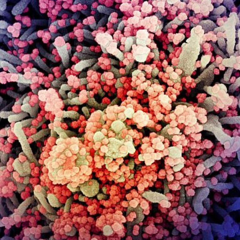 SARS-CoV-2 may use key carbohydrate to infect cells