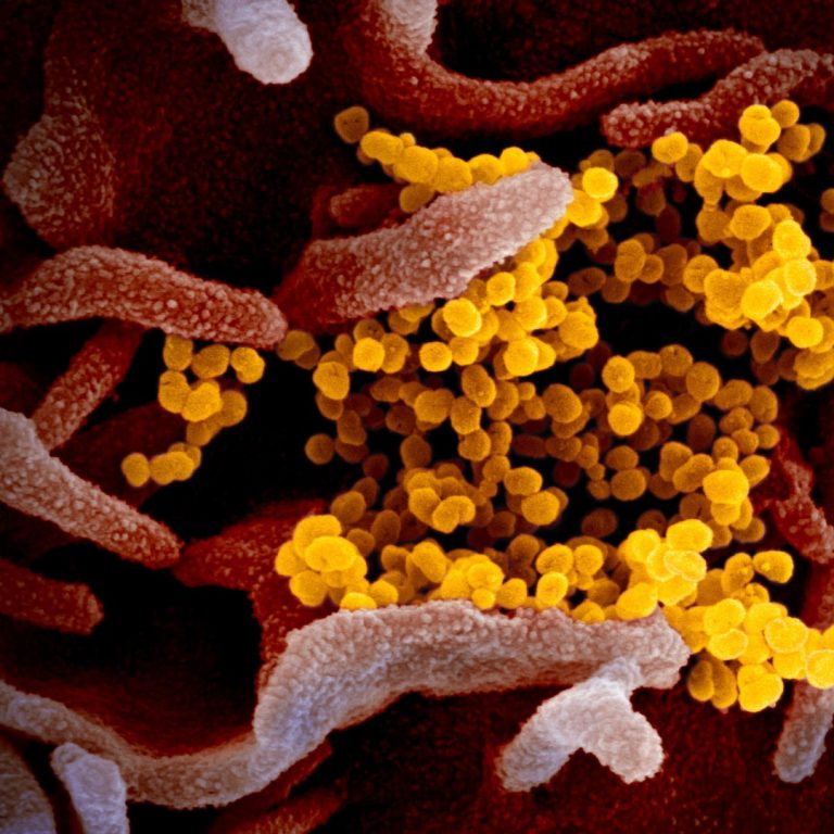 New images of novel Coronavirus SARS-CoV-2 made available