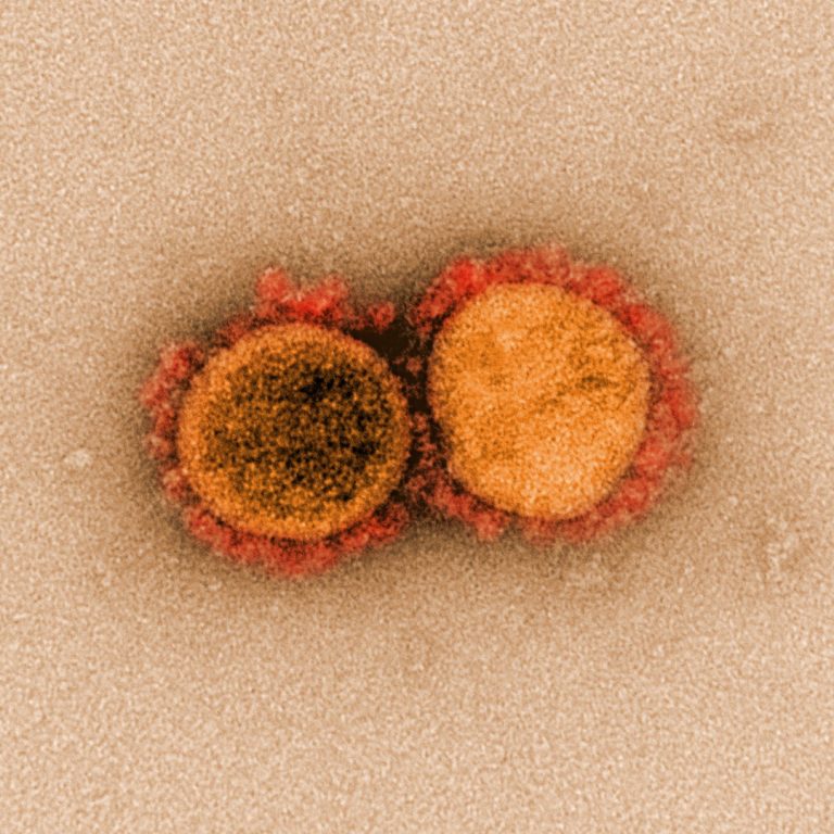 Nature publication presents new ‘Blueprint’ revealed how SARS-CoV-2 virus hijacks human cells