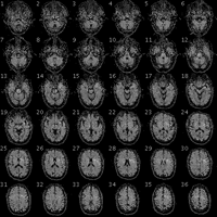 UC-Berkeley neuroscientists first used NMR to elucidate mental images