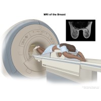 first Magnetic resonance imaging of human