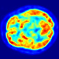 University of Missouri research reactor announced commercial shipments of radioisotope for cancer treatment