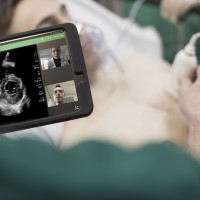 Philips received FDA clearance for use of ultrasound portfolio to manage COVID-19-related lung and cardiac complications