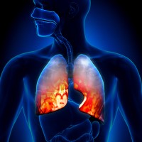 The FDA approved antibiotic to treat hospital-acquired bacterial pneumonia and ventilator-associated bacterial pneumonia