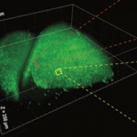 Large-scale analysis links glucose metabolism proteins in the brain to Alzheimerﾒs disease biology