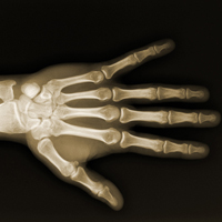 The first X-ray was produced at Yale