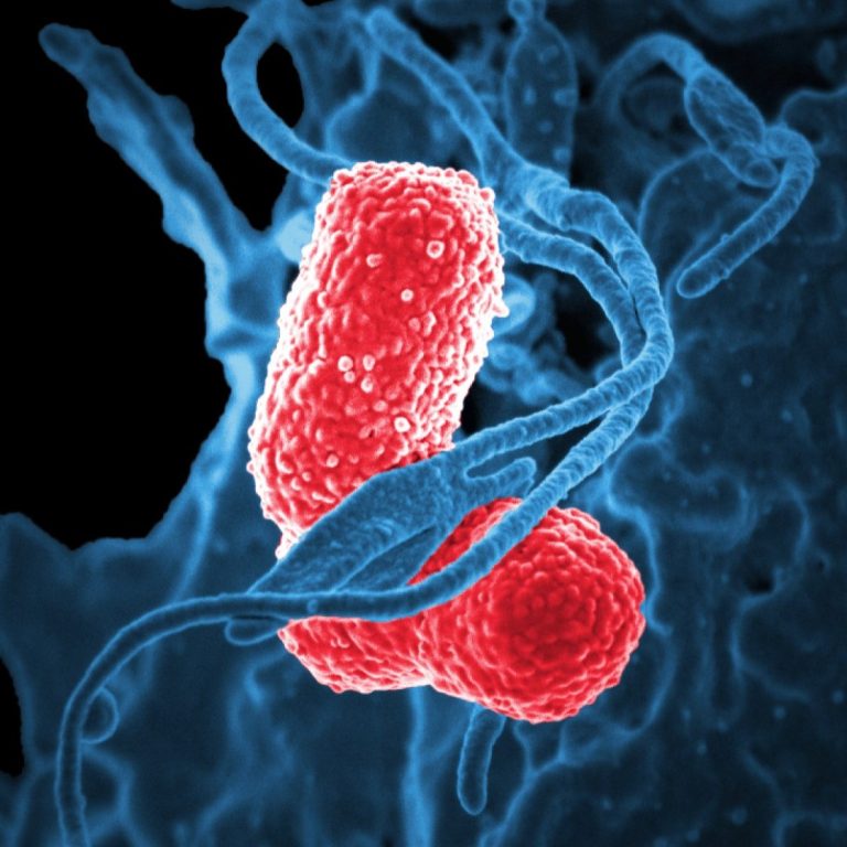 Scientists identified possible new transmission factor in hospital-acquired Klebsiella infections