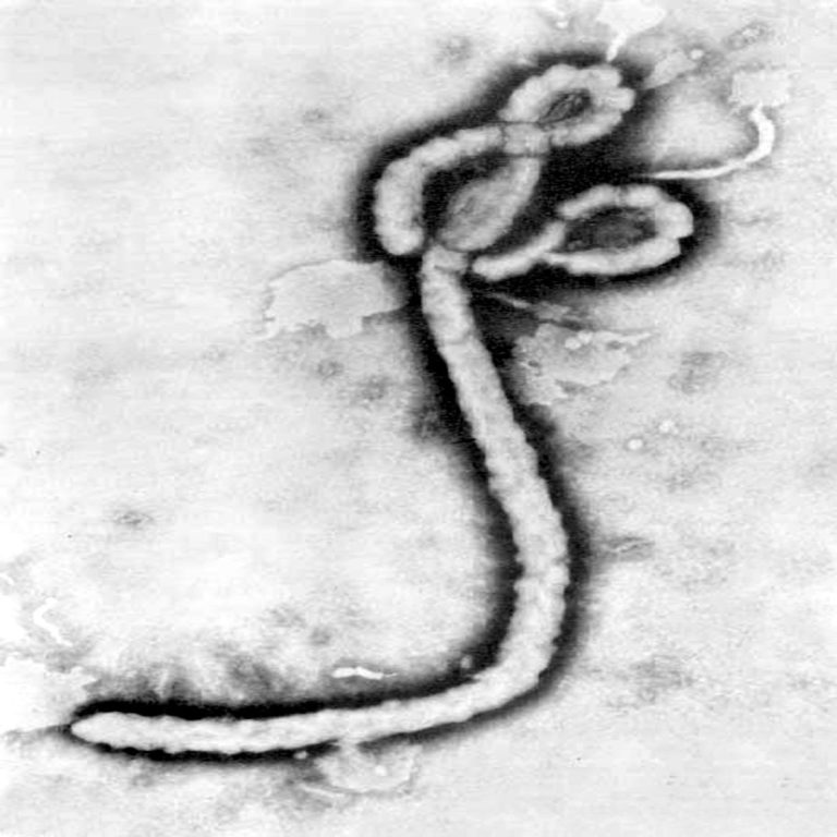 Resurgence of Ebola reported in North Kivu in the Democratic Republic of the Congo