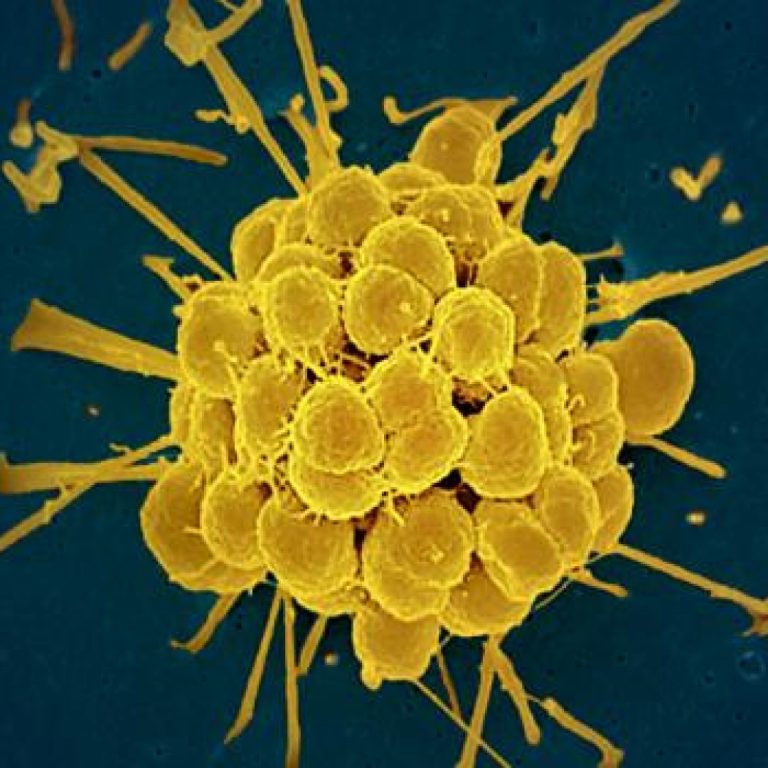 FDA Approves Two Oral Therapies to Treat Gonorrhea