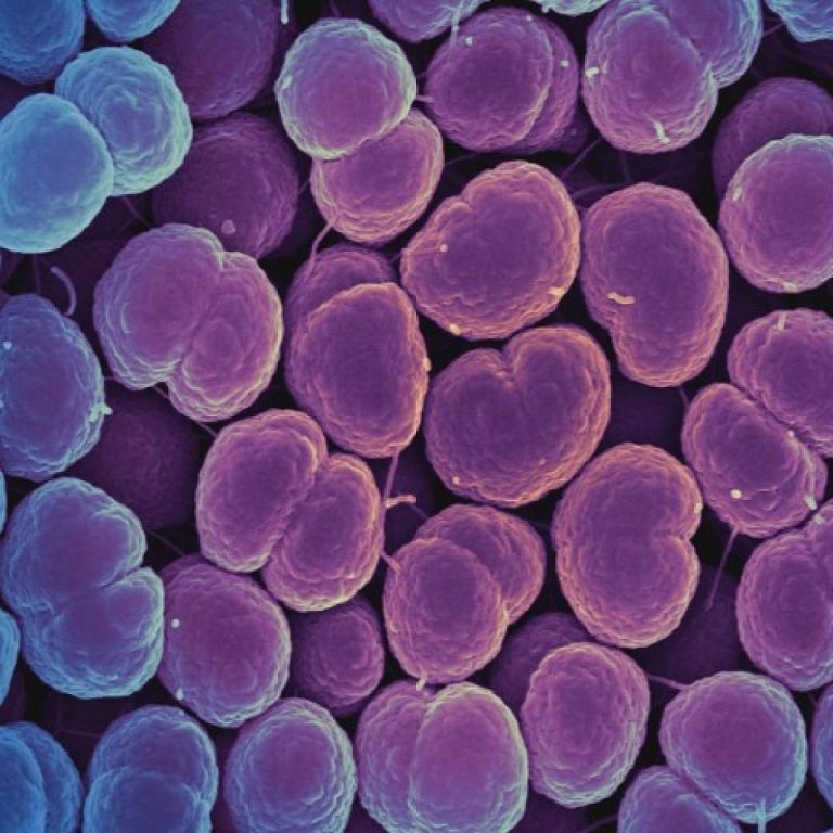 Rapid diagnostic for gonorrhea won $19 million federal prize competition to combat antibiotic resistance