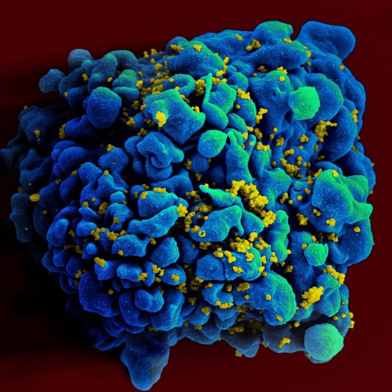 The first HIV case in history was recognized