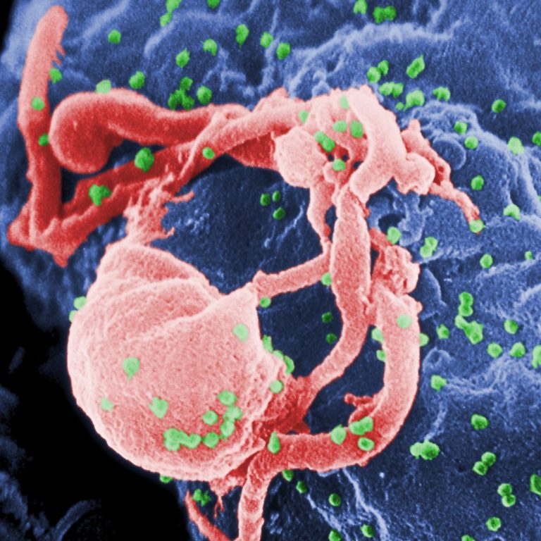 First-in-human clinical trial confirmed novel HIV vaccine approach