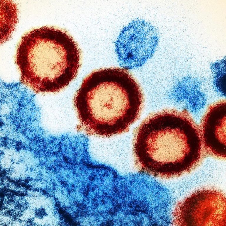 The CDC reported 413 cases of the new HIV disease in the US with 155 deaths