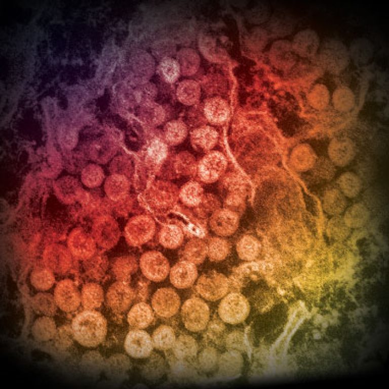 New MERS Coronavirus vaccine clinical trial started in Saudi Arabia