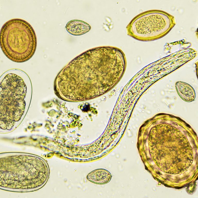 John Bozicevich developed immunological methods for the diagnosis of helminth parasitic infections