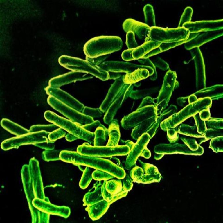 The CDC reported the pace of tuberculosis decline in the U.S. slowed in recent years