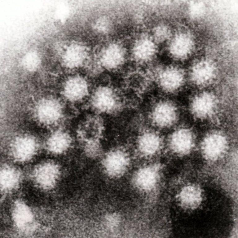 Vaxart announced publication that showed potential clinical and economic value of a Norovirus vaccine