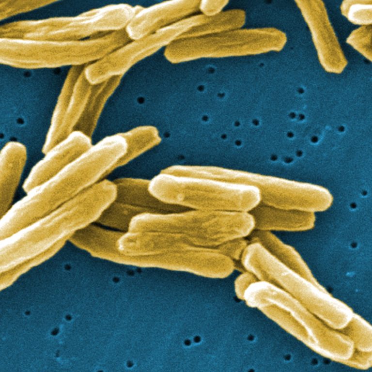 GSK licensed tuberculosis vaccine candidate to the Bill & Melinda Gates Medical Research Institute for continued development