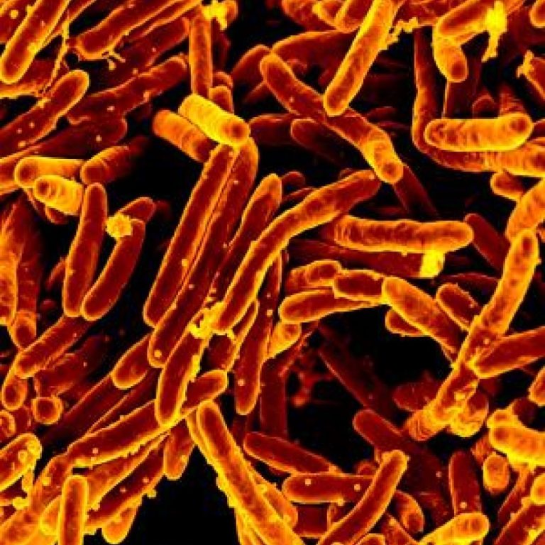 The CDC reported the first drug-resistant tuberculosis outbreak