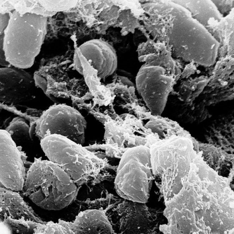 Public Health Officials Confirmed First Human Plague Case in Pueblo County, Colorado