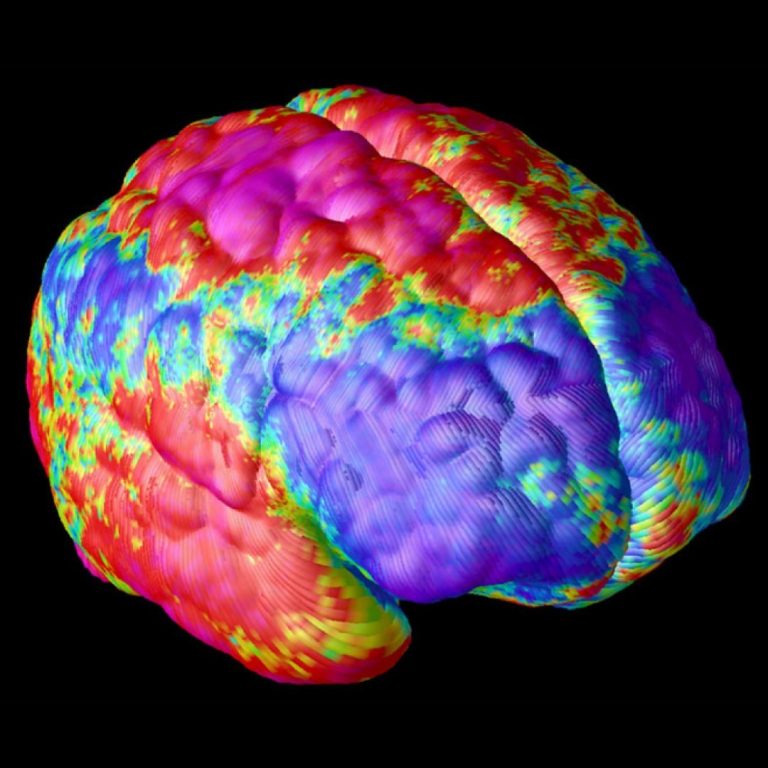 Researchers pinpoint biomarkers for schizophrenia